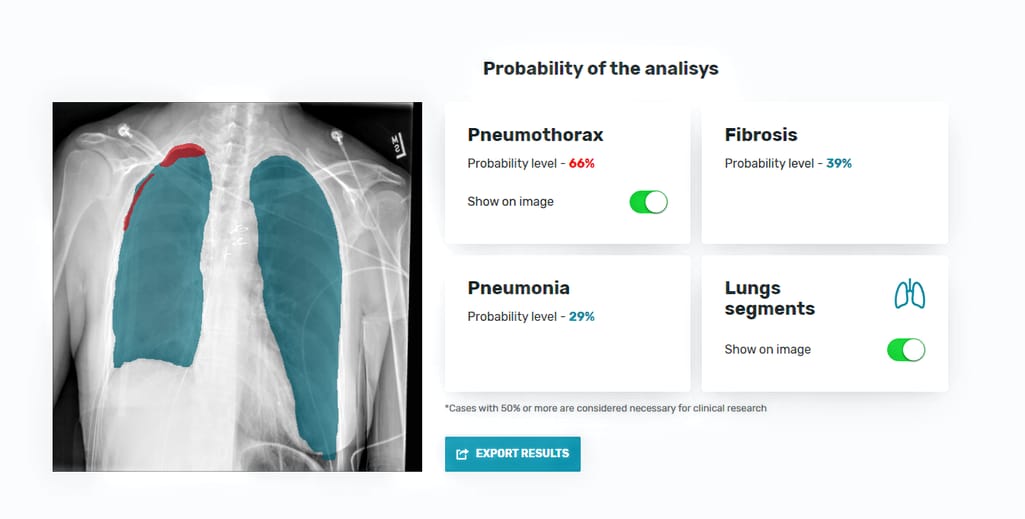 The interface of an AI-based diagnostic tool by AltexSoft