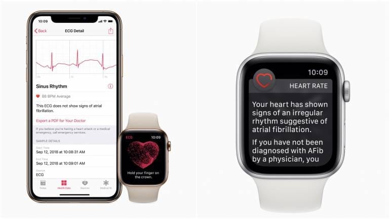 Apple Watch ECG feature