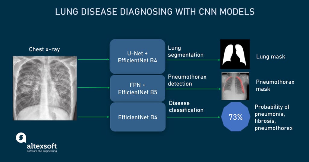 CNN models in lung disease detection